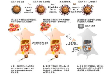 近红外二区探针实现增强卵巢癌转移灶的荧光成像手术导航